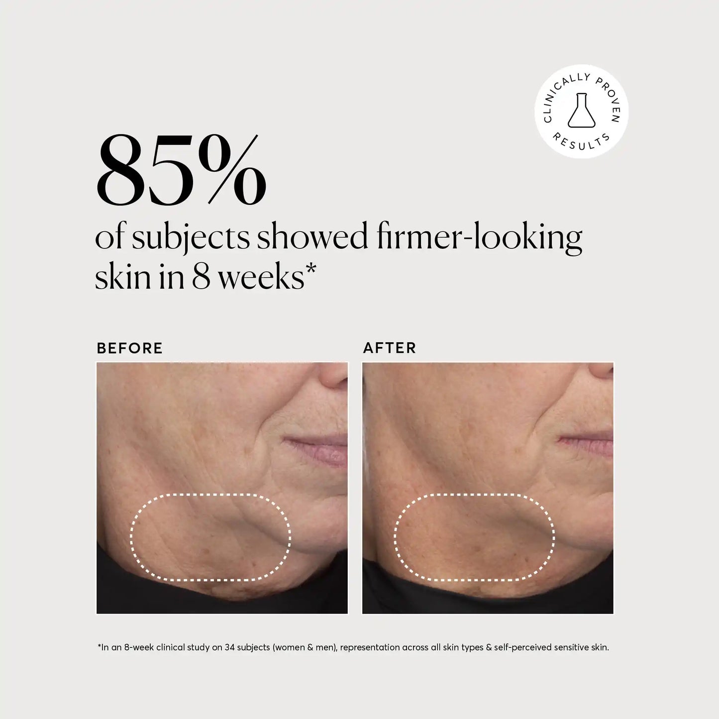 retinol-complex-serum-e2 NATR-10034-Alt-Images-Retinol-Complex-Serum-04.webp
